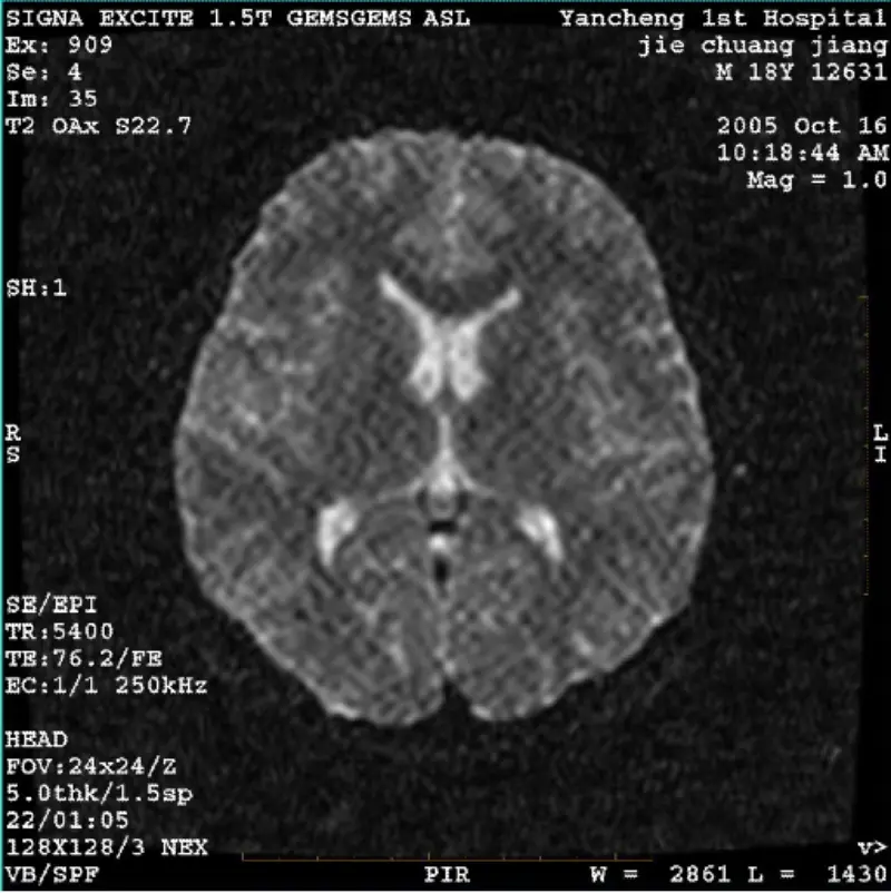 ఆర్టిఫాక్ట్ WI/ఫియస్టా ఇమేజ్ వైట్ పిక్సెల్